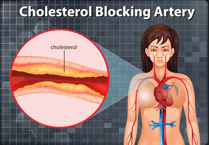 Dr. Harsh Parekh - Best Cholesterol Specialist in Borivali