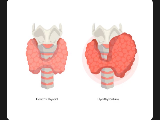 Dr. Harsh Parekh - Best Endocrinologist in Borivali