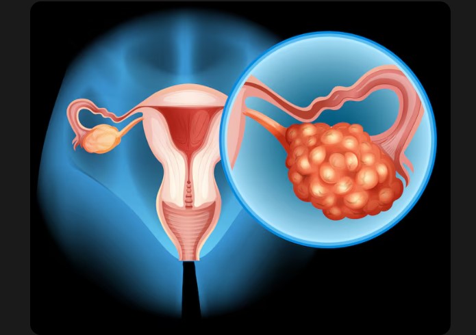 Dr. Harsh Parekh - Best PCOS Specialist in Borivali