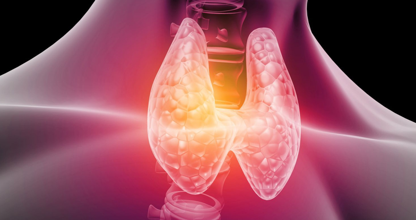 Hyperthyroidism