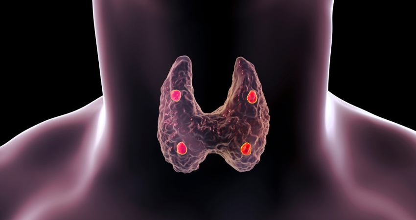 Parathyroid Disorders